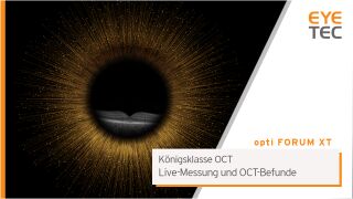 Königsklasse OCT