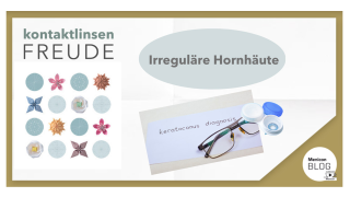 Menicon Blog - Irreguläre Hornhäute