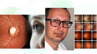 WVAO Seminar Fundus 1