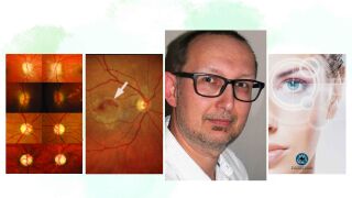 WVAO Seminar Fundus 2