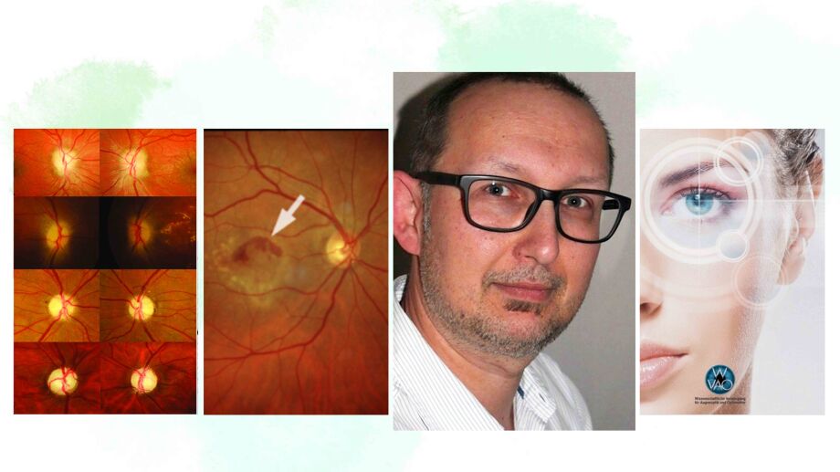 WVAO Seminar Fundus 2
