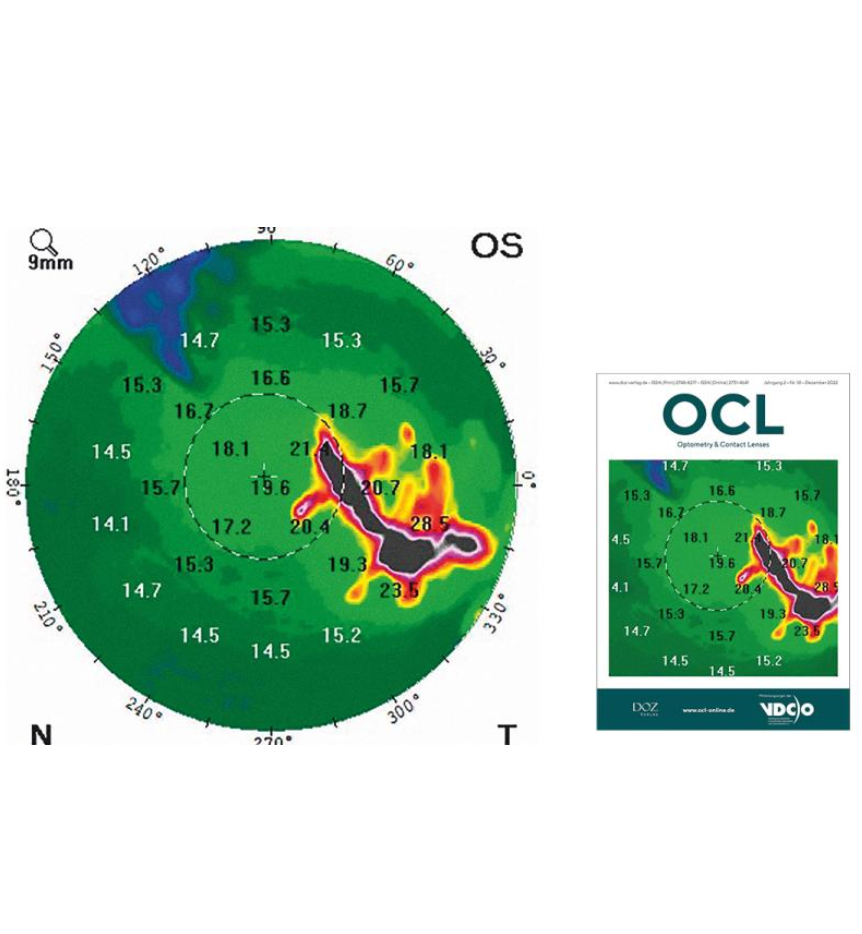 OCL Ausgabe