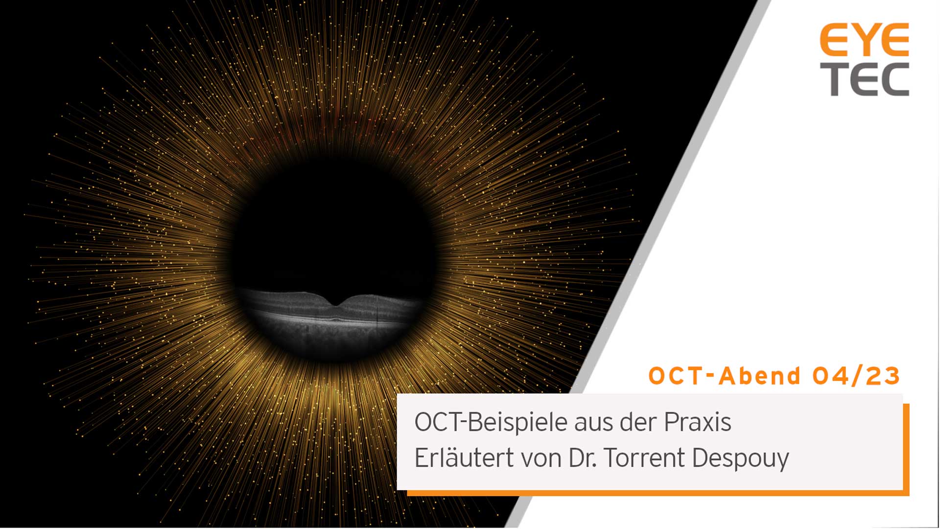 OCT-Beispiele aus der Praxis