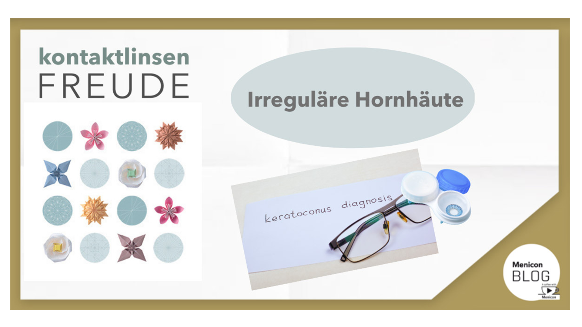 Menicon Blog - Irreguläre Hornhäute