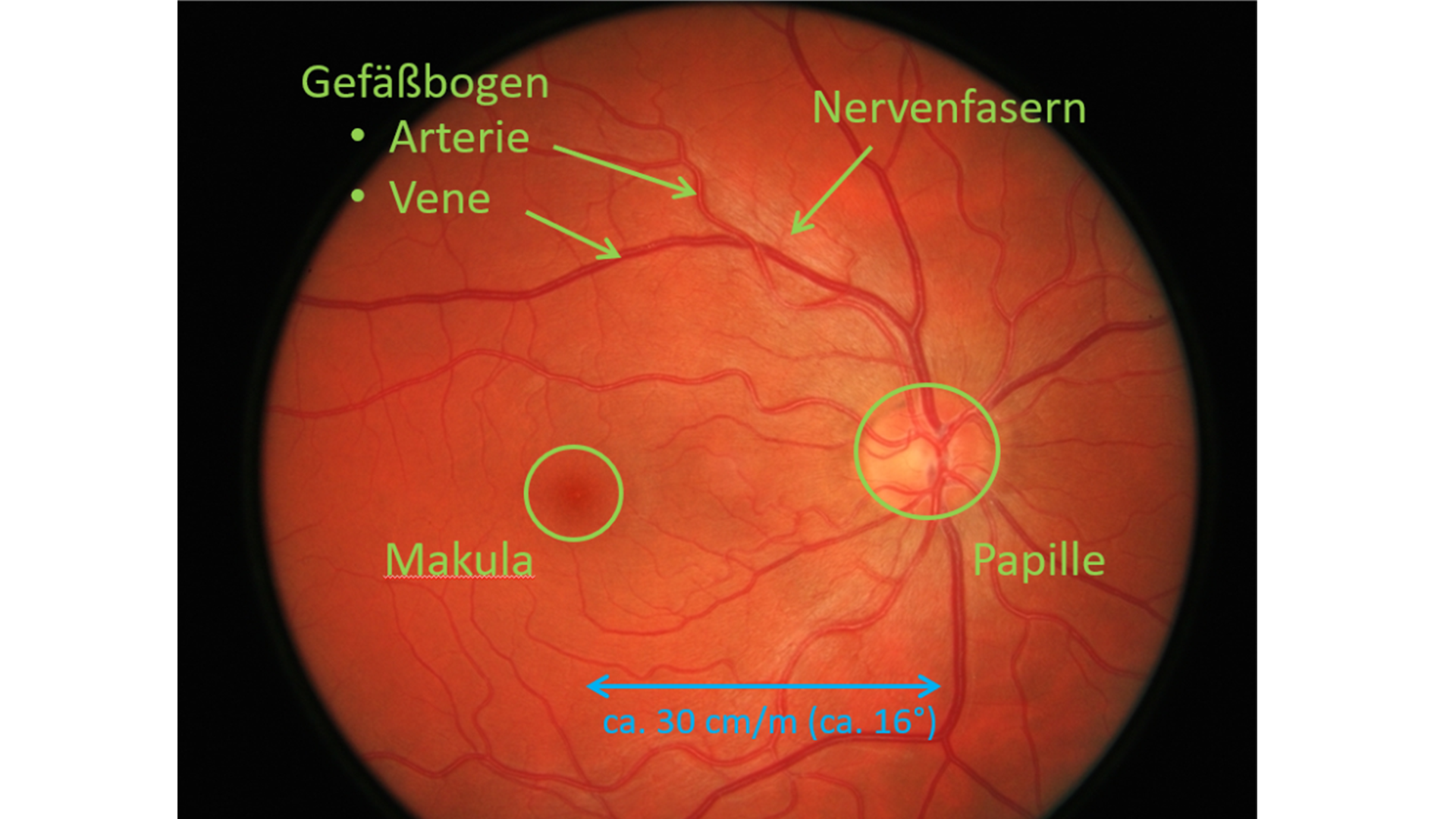 Netzhaut-Screening