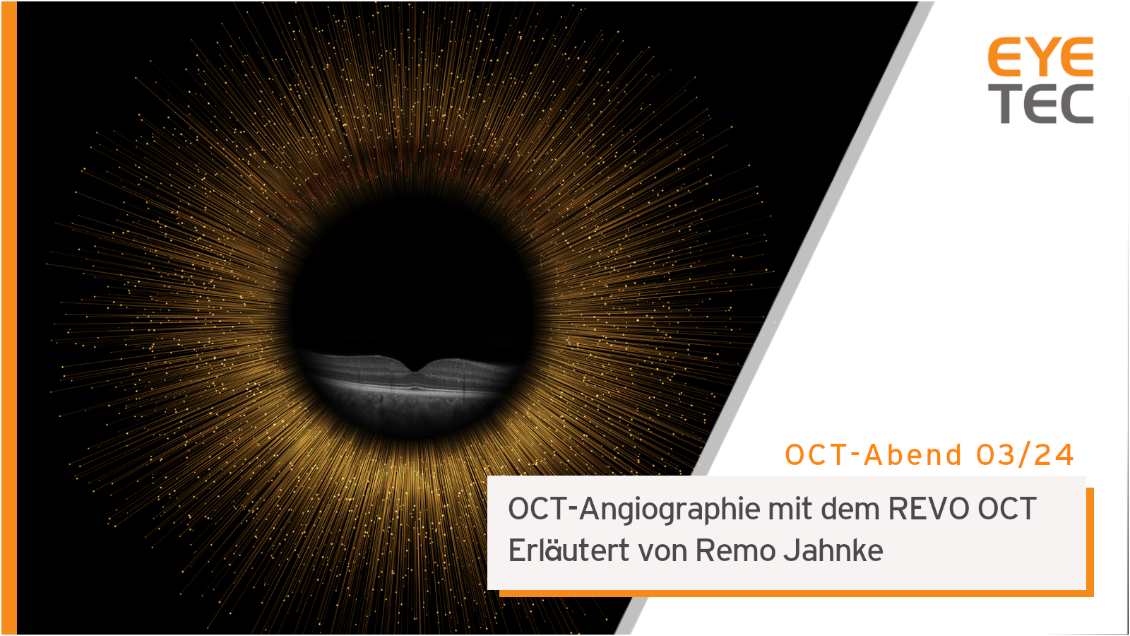 Eyetec OCT Abend