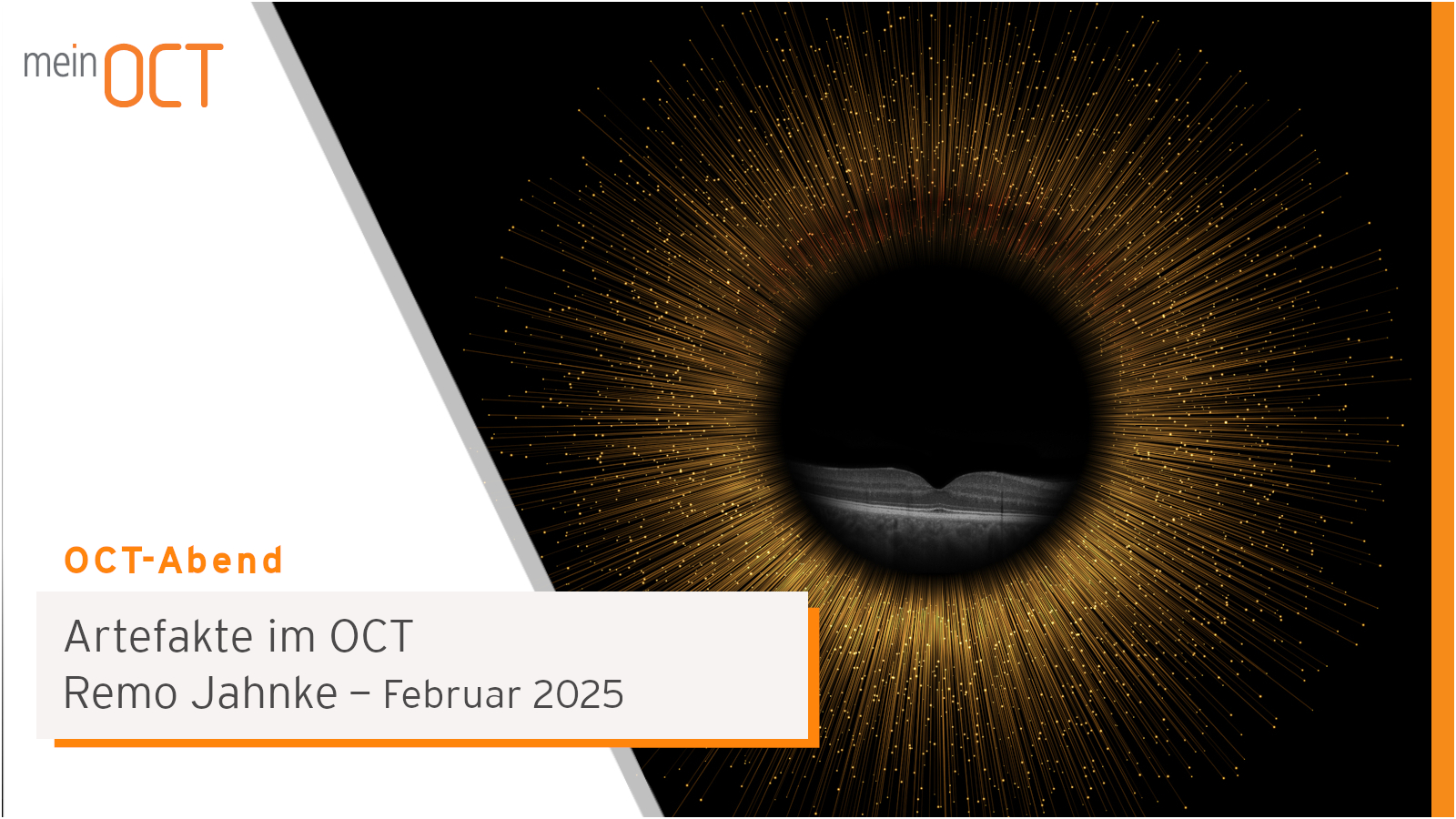 Eyetec OCT-Abend