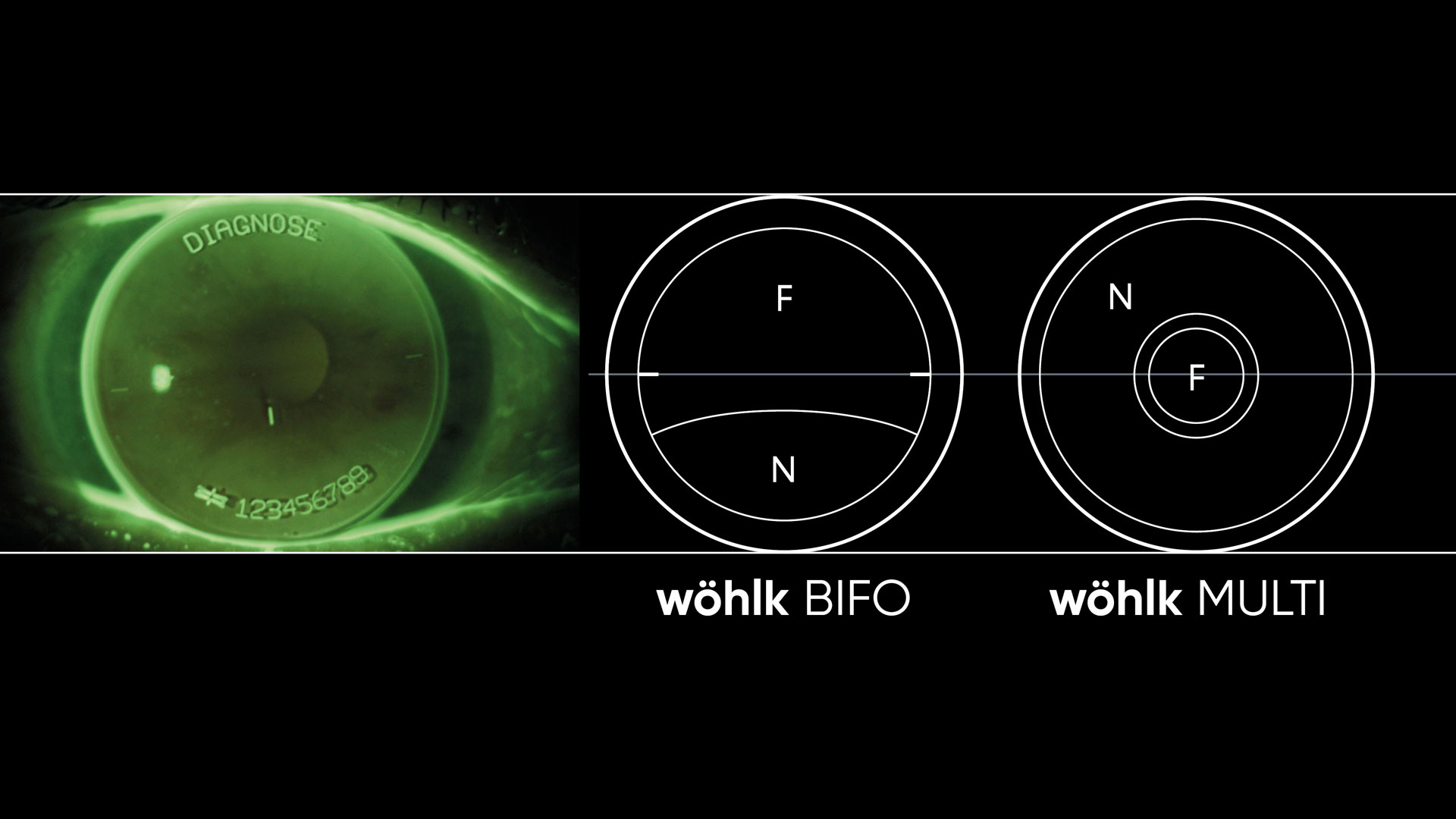 wöhlk bifo und multi