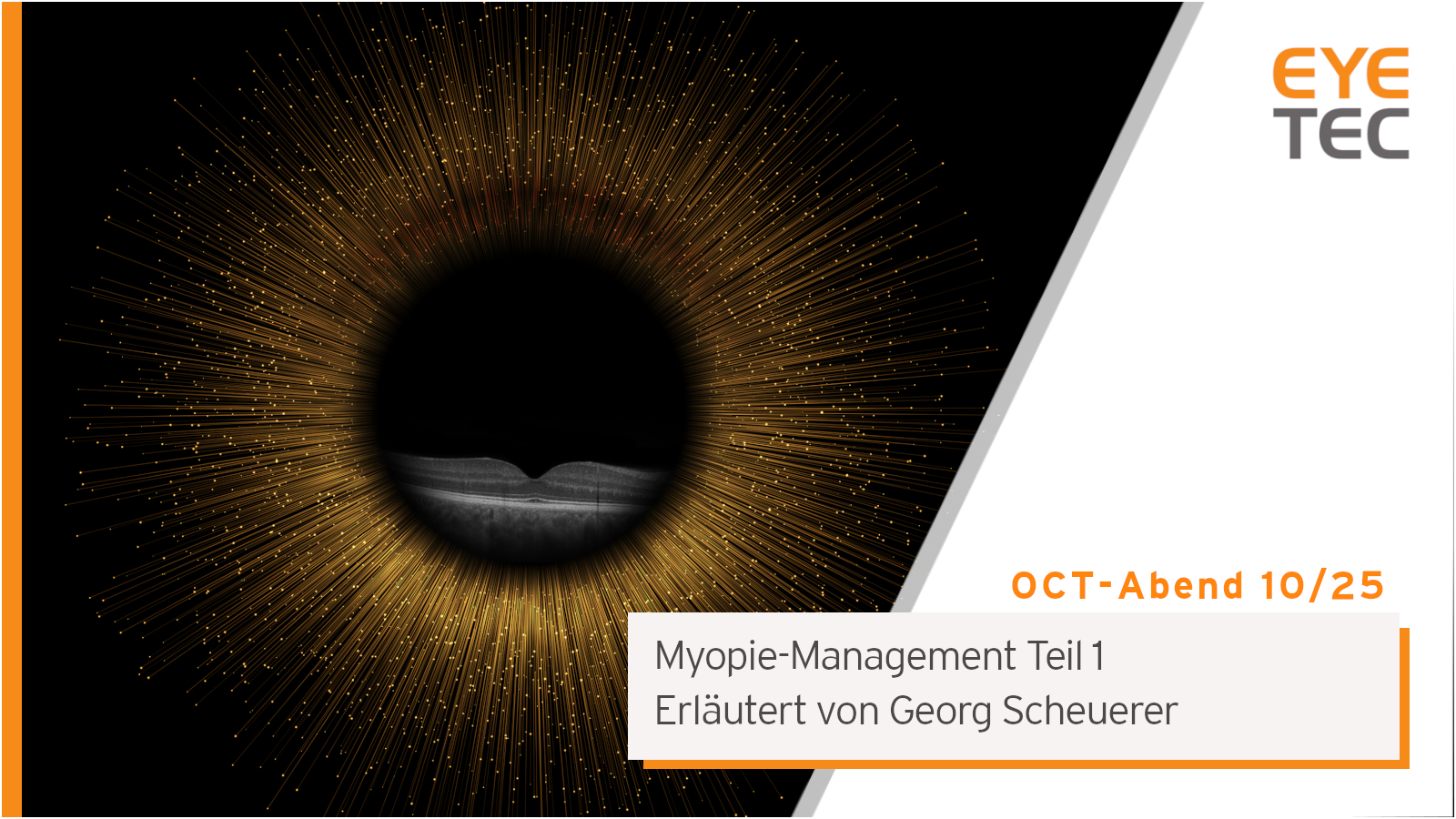 Eyetec OCT-Abend